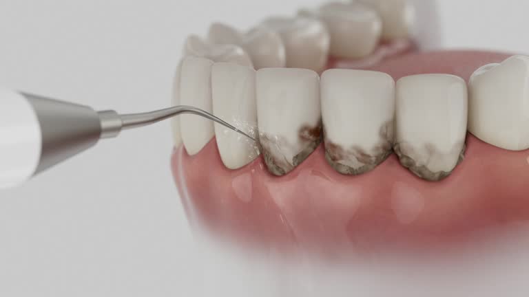 Trusted Teeth Cleaning And Checkup service in Pine Island Center, FL - Dentist Open Now